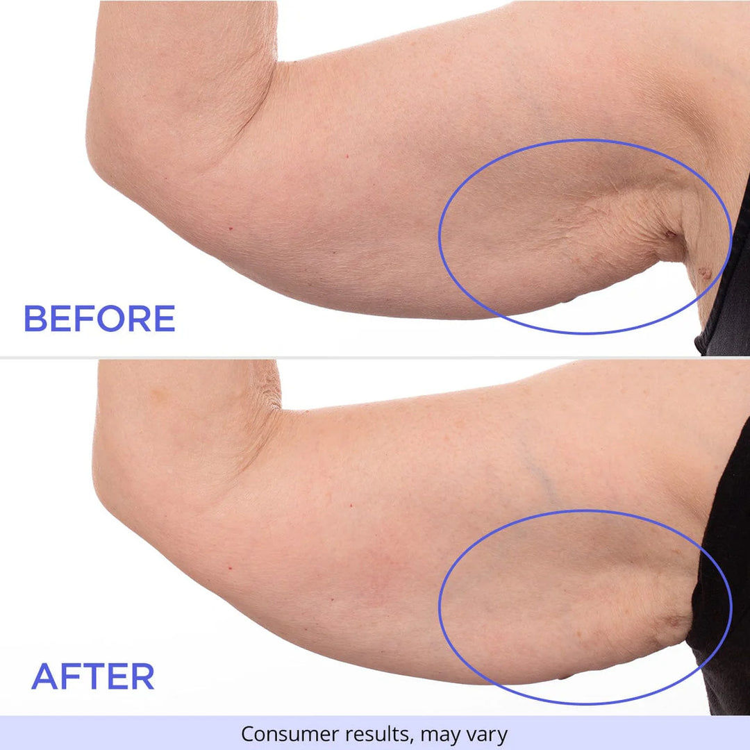 Firmaline Sculpt & Tone Arm Cream