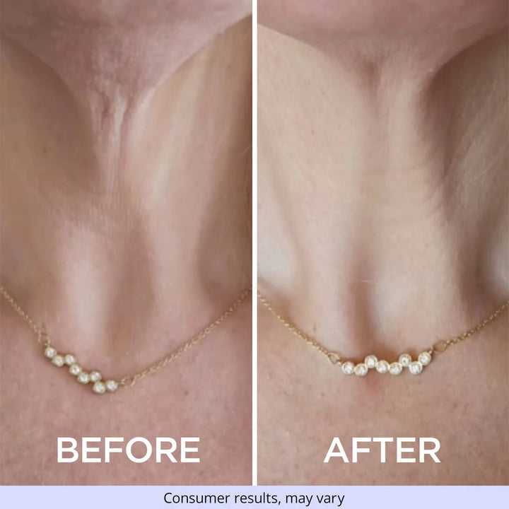 Firmaline Tighten & Lift Neck Cream - Buy One Get One Free Sale