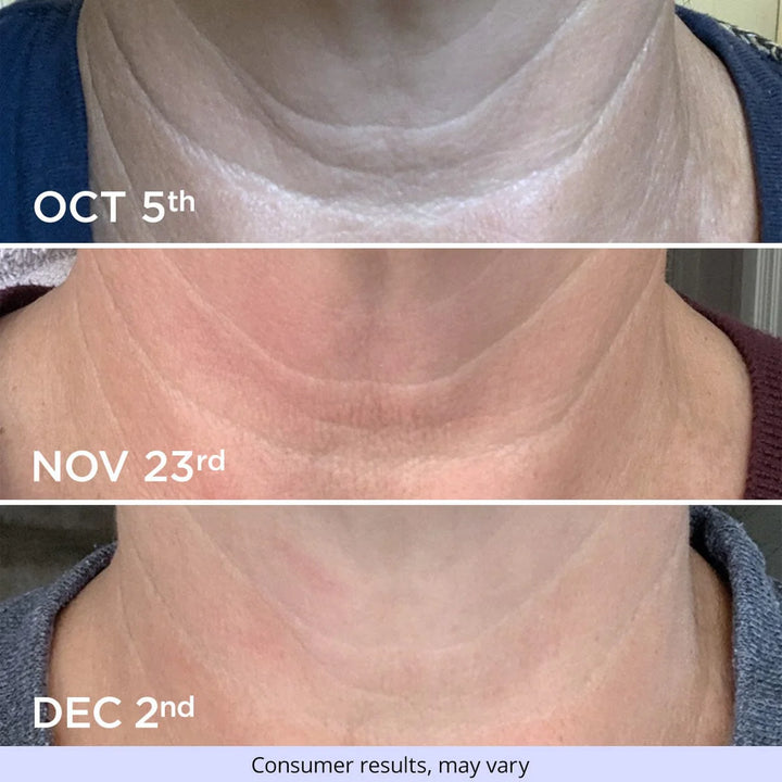 Firmaline Tighten & Lift Neck Cream - Buy One Get One Free Sale